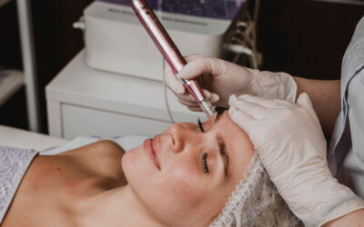 Microneedling Aftercare Guide: Tips for a Healthy and Radiant Complexion